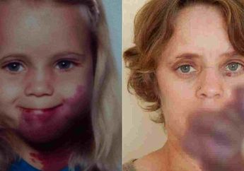 Punya Tanda Lahir, Wanita Ini Dijuluki 'Si Ungu Pemakan Manusia'