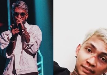 Terungkap, Wajah Babak Belur Young Lex Hanyalah Riasan      