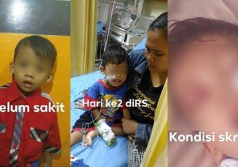 Peringatan Bagi Orang Tua! Seorang Balita Mengidap Kanker Darah Akibat Kecanduan Gadget 