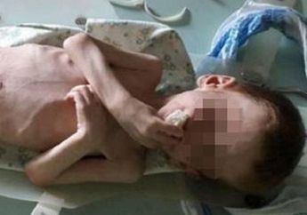 Keji! Orangtuanya Menelantarkan Sang Anak Hingga Hampir Mati Kelaparan
