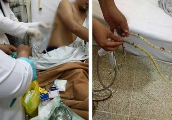 Miris! Akibat Kecanduan Rokok, Pria Ini Harus Makan dan Minum Pakai Selang