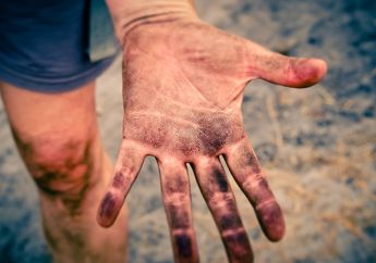 Ungkap Kepribadianmu yang Sesungguhnya Lewat Bentuk Jari Manis dan Kelingking