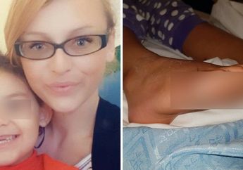 Kaki Balita ini Kena Infeksi Berbahaya Usai Coba Sepatu di Toko