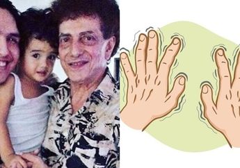 Faldy Meninggal Akibat Liver, Deteksi Penyakit ini dari Telapak Tangan