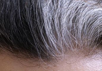 Rambut Mulai Beruban? Yuk Simak 5 Hal yang Harus Diketahui Tentang Uban