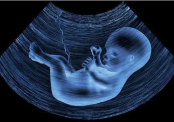 Efek Polusi Udara pada Janin, Bisa Merusak Otak Secara Permanen