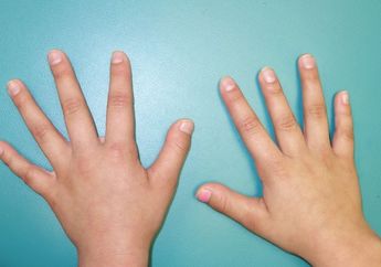 Terkuak, Panjang Jari Kelingking Dapat Menggambarkan Kepribadianmu!