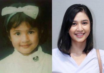 Imut Sejak Kecil! Ini Transformasi Penampilan Mikha Tambayong!