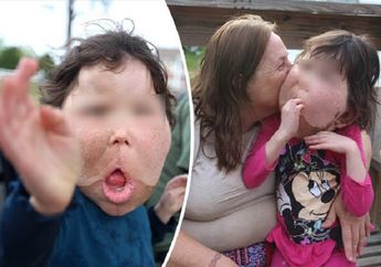 Katie Renfroe Alami Kondisi Langka, Dokter Bahkan Tak Bisa Jelaskan Penyakitnya