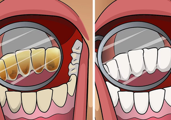 Tak Perlu ke Dokter Gigi, Bersihkan Karang dengan 4 Bahan Alami Ini