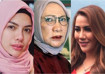 Deretan Artis Hingga Aktivis yang Terang-terangan Mengaku Operasi Plastik