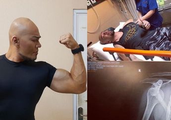Dikritik Karena Alami Cedera Bahu Pasca Latihan Bela Diri, Deddy Corbuzier: Bukan Cuma Gedein Badan Doang