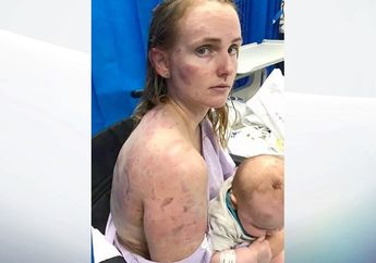 Tubuh Seorang Ibu Babak Belur Ketika Melindungi Bayinya dari Hujan, Begini Kronologinya