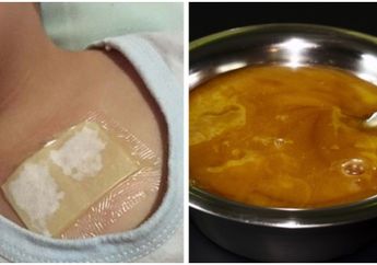 Tanpa Obat! Inilah Cara Meredakan Batuk dan Menghilangkan Dahak dalam Semalam