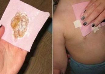 Ramuan Jahe Dipercaya Bisa Menyembuhkan Batuk dan Dahak tanpa Obat