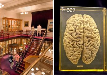 4 Museum Paling Mengerikan di Dunia, Salah Satunya Menyimpan Otak Einstein
