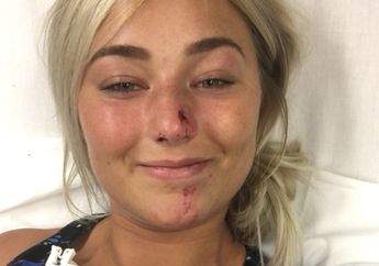 Jadi Korban Tabrak Lari, Wanita Ini Malah Pamer Alisnya yang Masih On Fleek