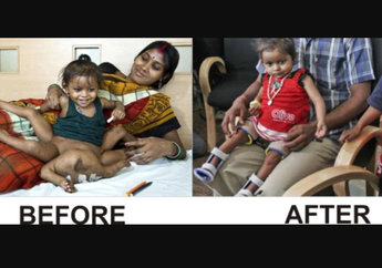 4 Kejadian Aneh dan Misterius yang Tak Terpecahkan, Mulai dari Manusia Gurita Hingga  Mesin Waktu di Indonesia