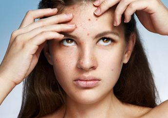 Ampuh Atasi Jerawat Menggunakan Rangkaian Produk Acnes Treatment Series