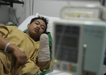 Tragis! Sempat Dikira Korban Mutilasi, Mahasiswa Ini Ditebas Tangannya Hingga Putus Akibat Cegah Begal