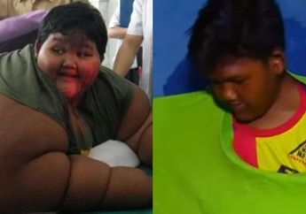 Inilah Penampilan Arya Permana Sekarang, Sang Bocah Obesitas Usai Turunkan Berat Badan Hingga 102 Kg