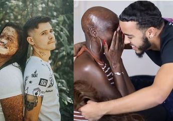 Cinta Tanpa Syarat, Para Pria Ini Pacari Wanita yang Wajahnya Ngeri