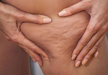 Hilangkan Selulit Secara Alami dengan Mengonsumsi Pisang dan Nanas
