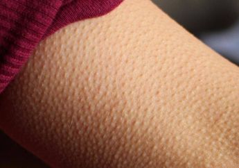 Saat Mendengarkan Lagu Bulu Kuduk Merinding? Tandanya Kamu Punya Emosi yang Lebih Kuat