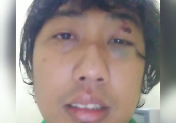 Dramatis! Cerita Komedian Ade Jigo yang Selamat dari Tsunami Banten, dan Ditemukan di Gorong-gorong Pembuangan Air Kolam Renang