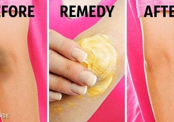 Gampang! ini 5 Tips Ampuh Putihkan Lutut dan Siku yang Menghitam!