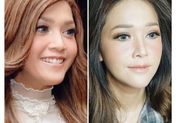 Inilah Awal Mula #10yearschallenge Beserta Deretan Artis yang Terlihat Awet Muda