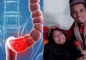 Istri Ustaz Maulana Meninggal Akibat Kanker Usus, Ketahui 4 Gejalanya Berikut ini