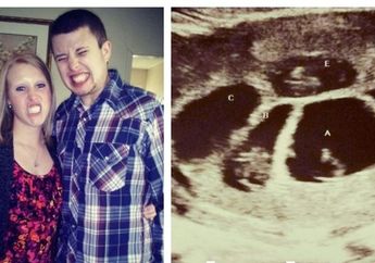 Divonis Mandul Oleh Dokter, 2 Tahun Kemudian Wanita Ini Lahirkan Bayi Kembar 5