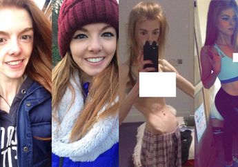 Dulu Kurus Kering Kayak Jerangkong, Wanita Inggris Ini Akhirnya Makan Satu Cemilan Ini dan Sukses Naikkan Berat Badan dari 28 Kg Jadi 45 Kg!