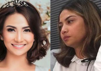 Jatuh Pingsan, Vanessa Angel Gunakan Kursi Roda Saat Tiba di RS Bhayangkara Surabaya