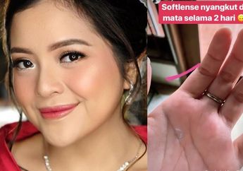 Ngeri! Softlens Nyangkut di Mata Tasya Kamila Selama 2 Hari, Begini Kondisi sang Artis Kini