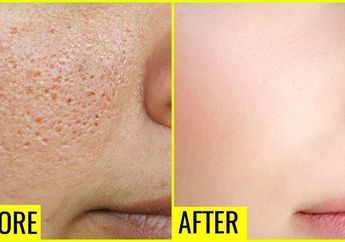 10 Bahan Alami untuk Mengatasi Pori-pori Wajah Besar, Ampuh Bikin Kulit Tampak Flawless!