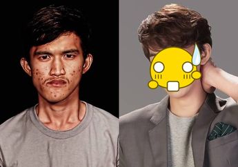 Buruh Thailand ini Jalani Operasi Plastik, Hasilnya Bak Idol K-Pop Hingga Bikin Ibu dan Pacarnya Pangling!