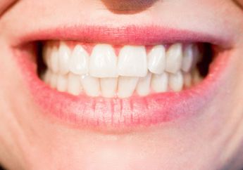 Tak Perlu Veneer Gigi Mahal-mahal, Simak 4 Cara Memutihkan Gigi dengan Bahan Alami Berikut Ini!