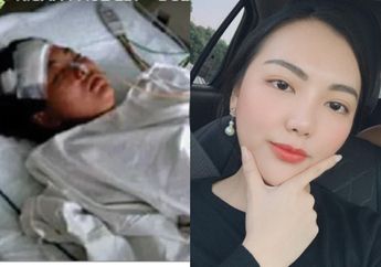 Beneran Ditusuk Teman Sesama Cewe Sampe Paru-parunya Bocor, YouTuber Indonesia Ini Kaget Pelaku Malah Senyum-senyum Usai Brutal Ingin Habisi Nyawanya: Limpa Juga Bocor