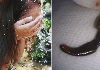 Mengerikan! Wanita Ini Menemukan Lintah Berukuran 5 Cm di Hidung Usai Membasuh Wajah dengan Aliran Air di Gunung