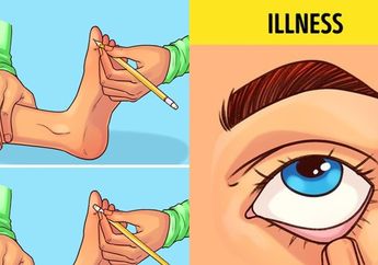 Coba Lakukan 5 Tes Kesehatan Berikut, Bisa Deteksi Penyakit Serius dari Stroke Hingga Diabetes