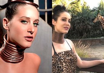 Terobsesi dengan Jerapah, Wanita ini Regangkan Lehernya Selama 5 Tahun Begini Nasibnya Sekarang