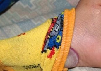 Belum Banyak yang Tahu, Ini 3 Manfaat Selipkan Bawang Merah di Telapak Kaki Saat Tidur!