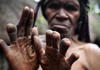 Iki Palek, Ritual Potong Jari yang Dilakukan Suku Dani Setiap Ada Kerabat yang Meninggal