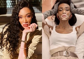 Kisah Winnie Harlow, Model Victoria Secret yang Sempat Di-bully karena Alami Kelainan Kulit