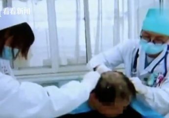 Salah Ambil Botol Sampo, Pria Ini Malah Keramas Pakai Pestisida Berkadar Racun Tinggi, Begini Nasibnya Sekarang