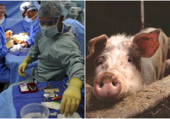 Viral Kisah Kematian Remaja dengan Ratusan Cacing Pita Bersarang di Otaknya, Diduga Gara-gara Makan Daging Babi yang Tak Matang!