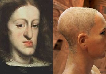 14 Kelainan Mengerikan ini Akan Terjadi Pada Anak dari Pernikahan Sedarah!