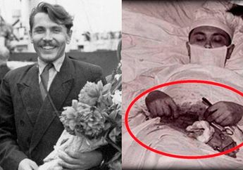 Kisah Dokter Rogozov, Nekat Bedah Isi Perutnya Sendiri di Tengah Badai Salju